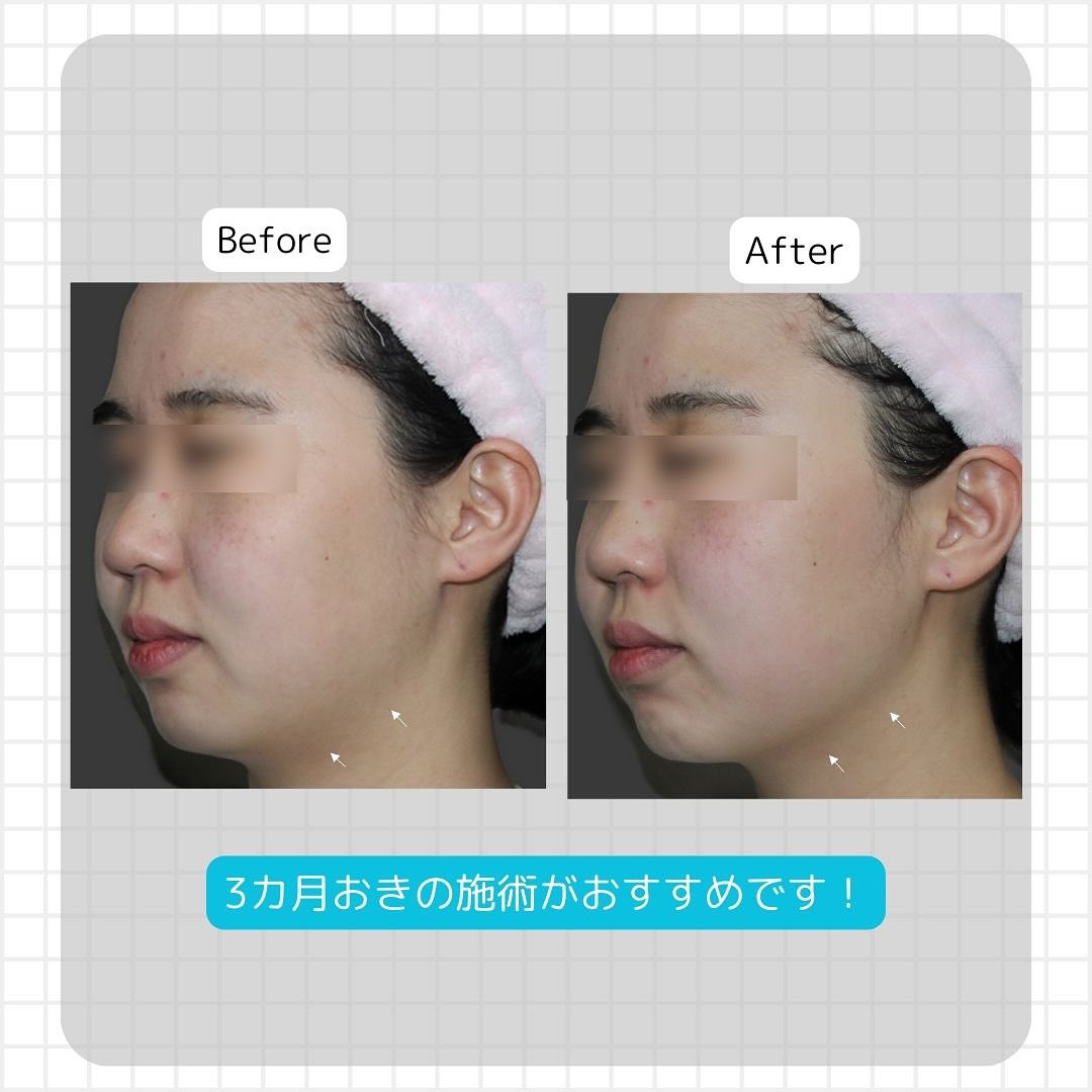 オリジオによるビフォーアフター